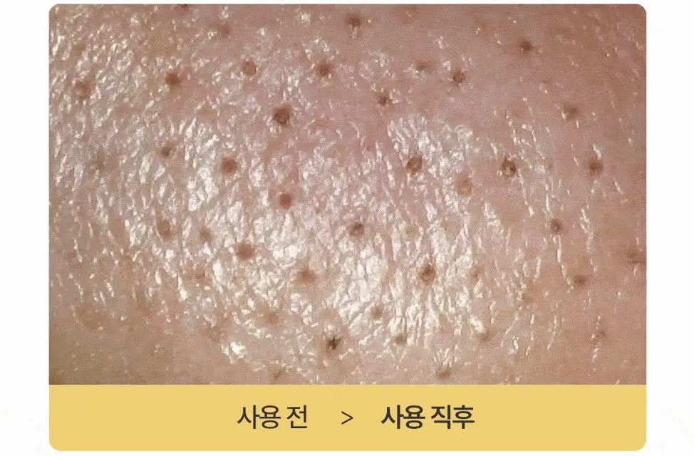 [리아킴 공동개발/단독선런칭] NDP 엔디피 모링가 세라마이드 멜팅 클렌징밤 90ml 기획 (+3ml*6입 ) 상세페이지 31